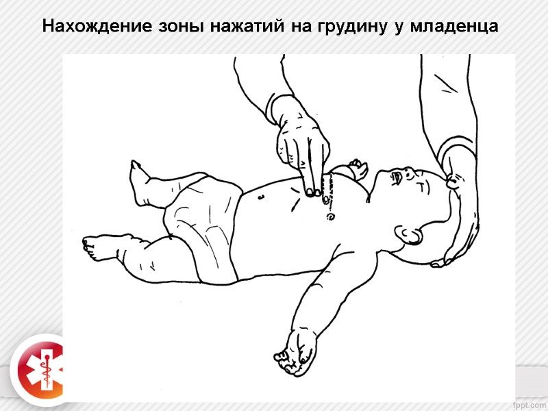 Нахождение зоны нажатий на грудину у младенца